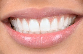 Closeup of flawless teeth and gums