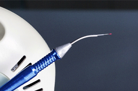 Close-up of soft tissue dental laser used in gum recontouring