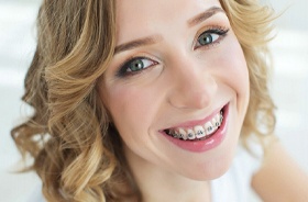 woman with braces