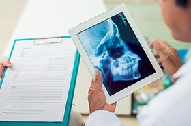 Dental x-rays on tablet computer