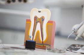 Model of the inside of the tooth