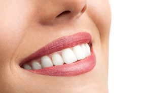 Close-up of beautiful smile with tooth-colored fillings in Buzzards Bay